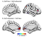Distinct and common aspects of physical and psychological self-representation in the brain:A meta-analysis of self-bias in facial and self-referential judgements
